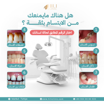 تجميل الاسنان (1)